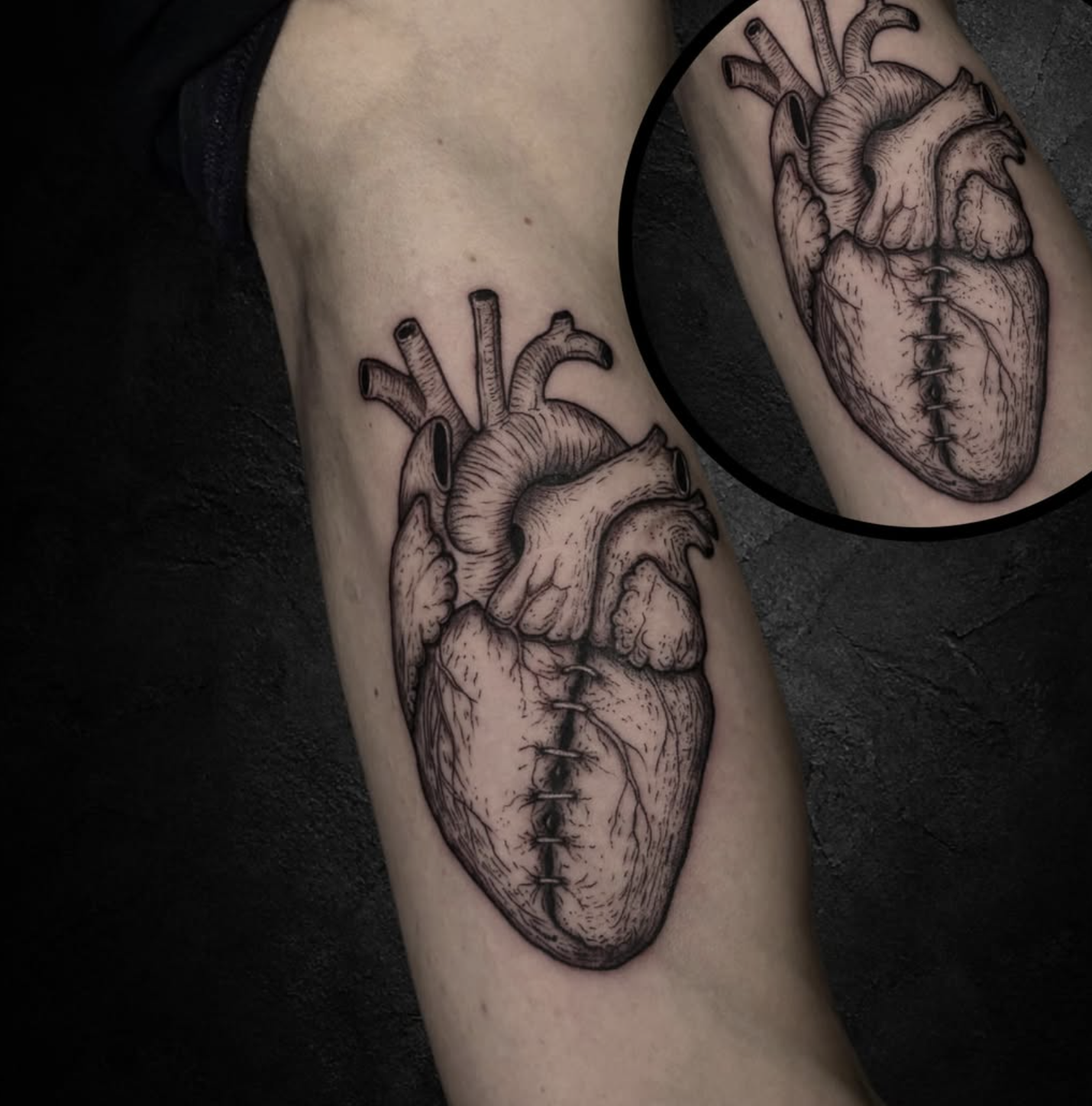 Blackwork Käfer Tattoo am Bein